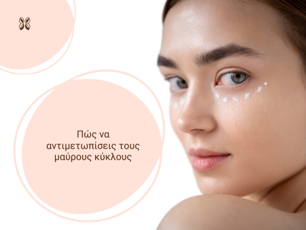 Πώς να αντιμετωπίσεις τους μαύρους κύκλους