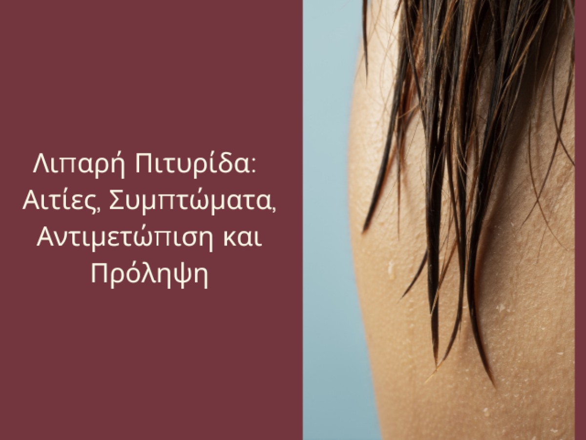 Λιπαρή Πιτυρίδα: Αιτίες, Συμπτώματα, Αντιμετώπιση και Πρόληψη