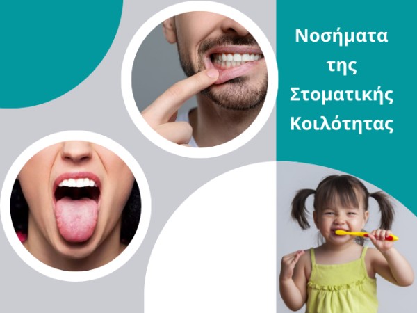 Νοσήματα της Στοματικής Κοιλότητας