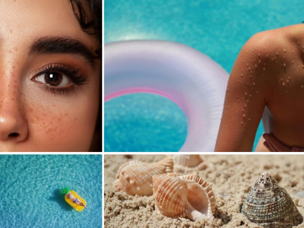 Έκθεση στον ήλιο: Πώς να αποφύγεις τις βλαβερές συνέπειες.