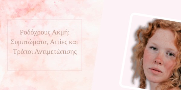 Ροδόχρους Ακμή: Συμπτώματα, Αιτίες και Τρόποι Αντιμετώπισης