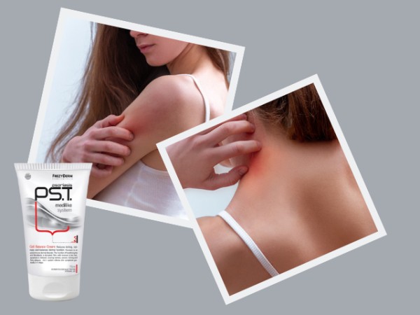 Ψωρίαση: Διάγνωση & Αντιμετώπιση